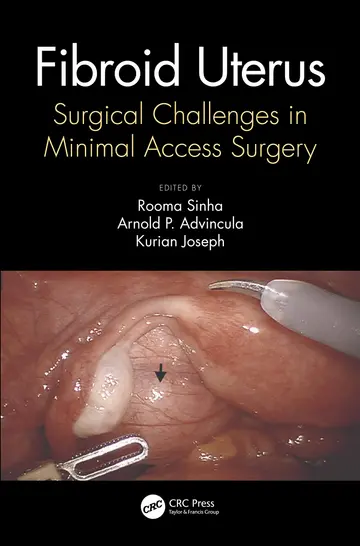 Cover of Fibroid Uterus Surgical Challenges in Minimal Access Surgery