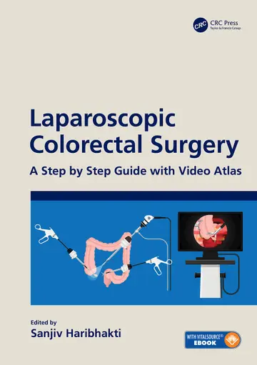 Cover of Laparoscopic Colorectal Surgery A Step by Step Guide with Video Atlas