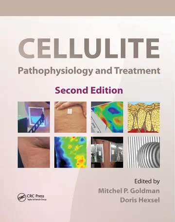 Cover of Cellulite