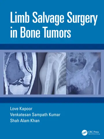 Cover of Limb Salvage Surgery in Bone Tumors