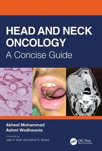 Cover of Head and Neck Oncology A Concise Guide