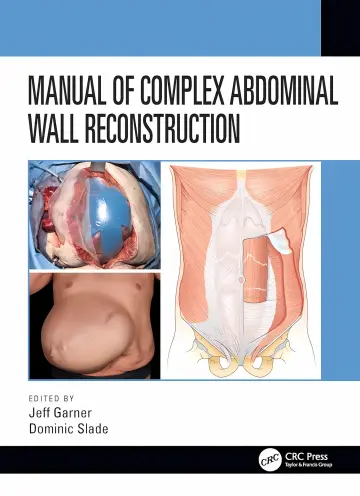 Cover of Manual of Complex Abdominal Wall Reconstruction