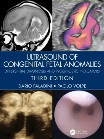 Cover of Ultrasound of Congenital Fetal Anomalies