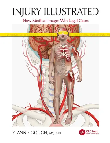 Cover of Injury Illustrated
