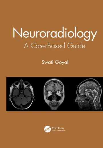 Cover of Neuroradiology