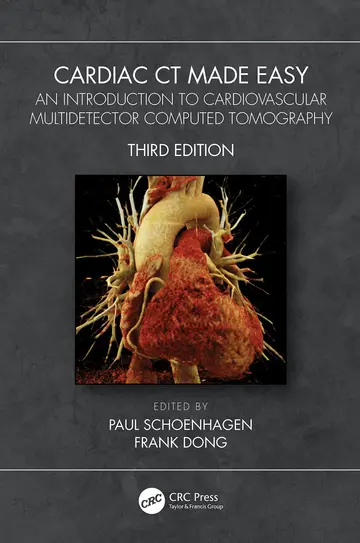 Cover of Cardiac CT Made Easy