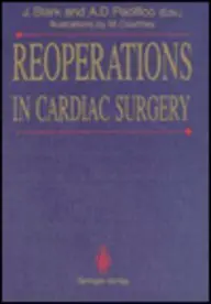 Cover of Reoperations in Cardiac Surgery