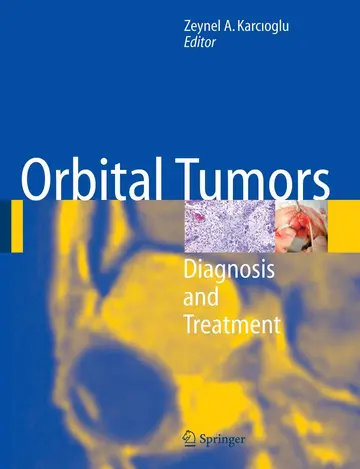 Cover of Orbital Tumors