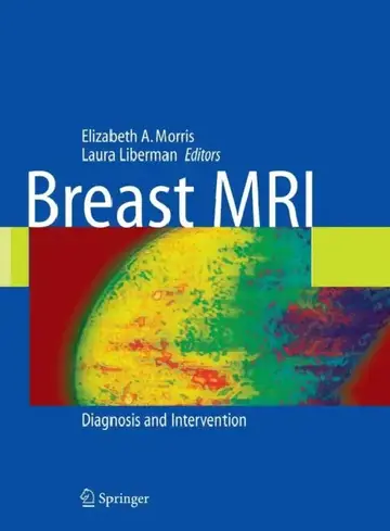 Cover of Breast MRI