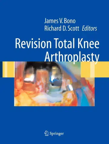 Cover of Revision Total Knee Arthroplasty
