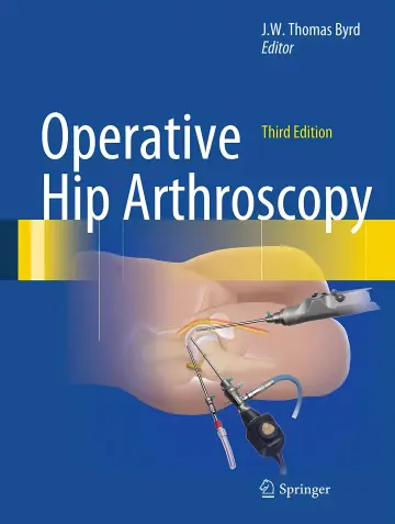 Cover of Operative Hip Arthroscopy
