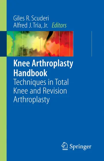 Cover of Knee Arthroplasty Handbook