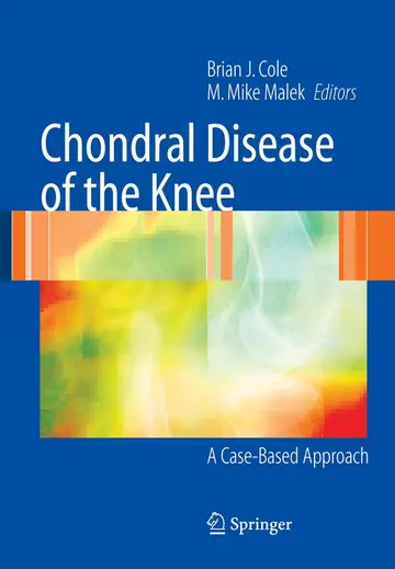 Cover of Chondral Disease of the Knee