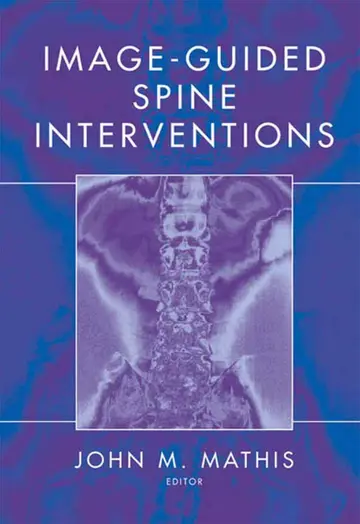 Cover of Image-guided Spine Interventions