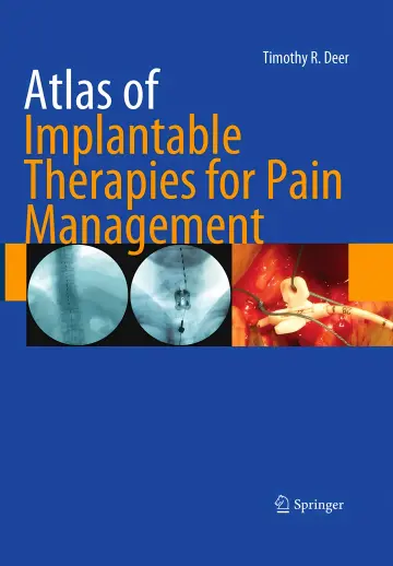 Cover of Atlas of Implantable Therapies for Pain Management