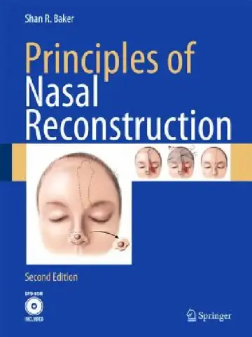 Cover of Principles of Nasal Reconstruction