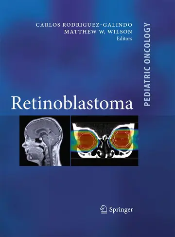 Cover of Retinoblastoma