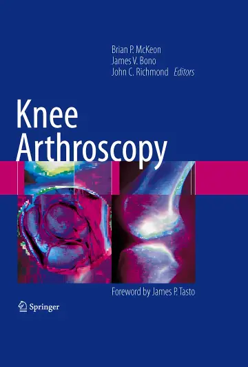 Cover of Knee Arthroscopy