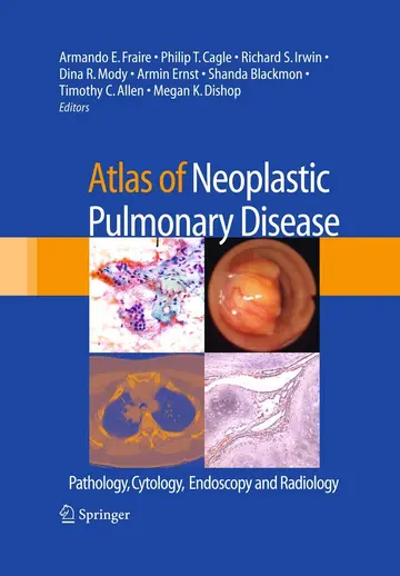 Cover of Atlas of Neoplastic Pulmonary Disease