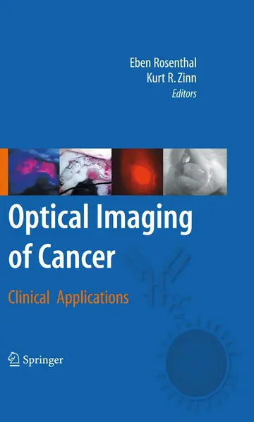 Cover of Optical Imaging of Cancer