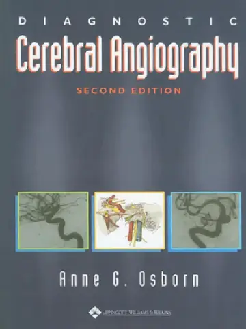 Cover of Diagnostic Cerebral Angiography