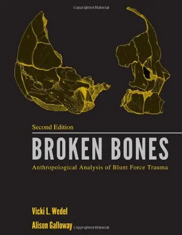 Cover of Broken Bones
