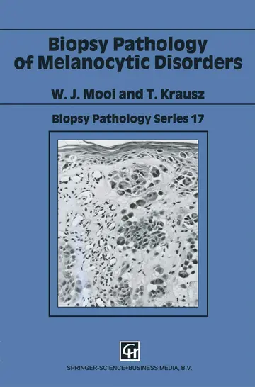 Cover of Biopsy Pathology of Melanocytic Disorders