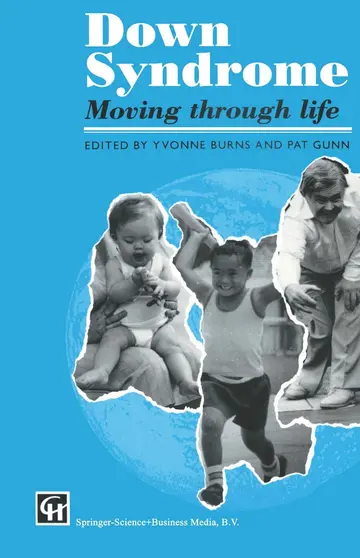 Cover of Down Syndrome