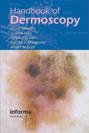 Cover of Handbook of Dermoscopy