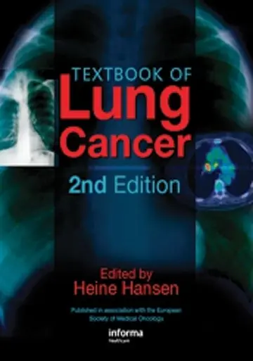 Cover of Textbook of Lung Cancer