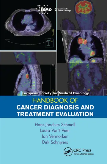 Cover of ESMO Handbook of Cancer Diagnosis and Treatment Evaluation