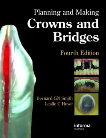 Cover of (Ex)Planning and Making Crowns and Bridges