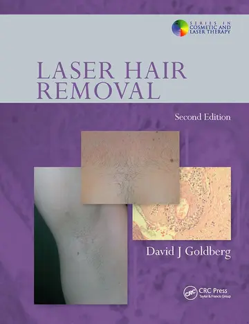 Cover of Laser Hair Removal