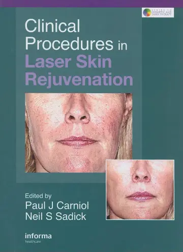 Cover of Clinical Procedures in Laser Skin Rejuvention