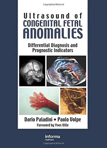 Cover of Ultrasound of Congenital Fetal Anomalies