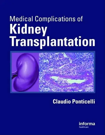 Cover of Medical Complications of Kidney Transplantation