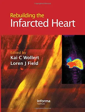 Cover of Rebuilding the Infarcted Heart