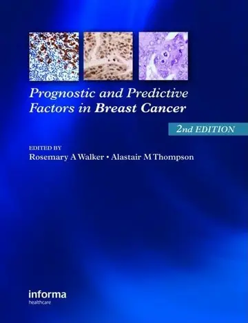 Cover of Prognostic and Predictive Factors in Breast Cancer