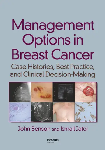Cover of Management Options in Breast Cancer