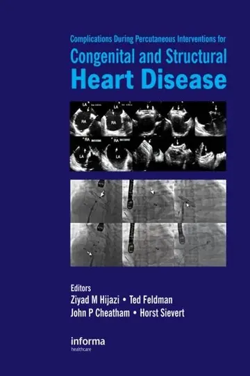 Cover of Complications During Percutaneous Interventions for Congenital and Structural Heart Disease
