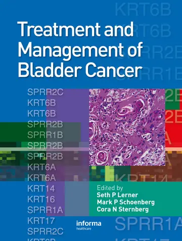Cover of Treatment and Management of Bladder Cancer