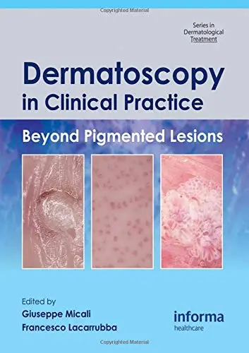 Cover of Dermatoscopy in Clinical Practice