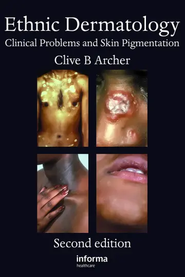 Cover of Ethnic Dermatology