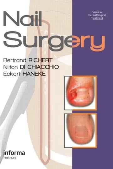 Cover of Nail Surgery