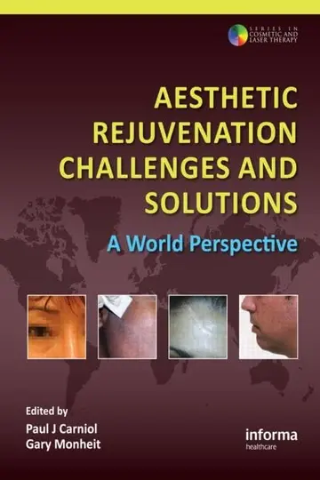 Cover of Aesthetic Rejuvenation Challenges and Solutions a World Perspective (hb 2010)