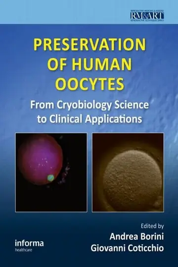 Cover of Preservation of Human Oocytes