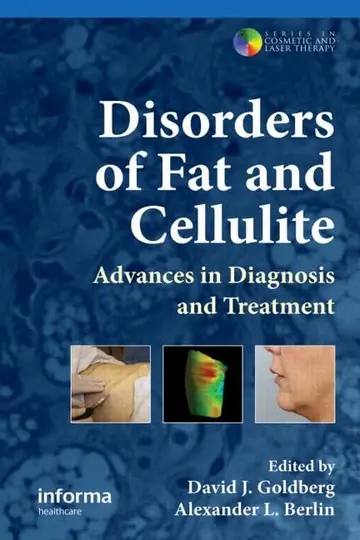Cover of Disorders of Fat and Cellulite