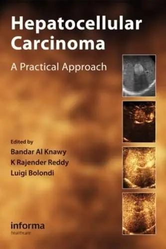 Cover of Hepatocellular Carcinoma