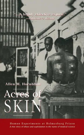Cover of Acres of Skin