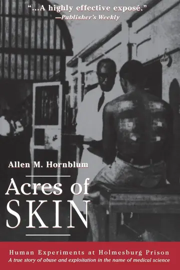 Cover of Acres of Skin